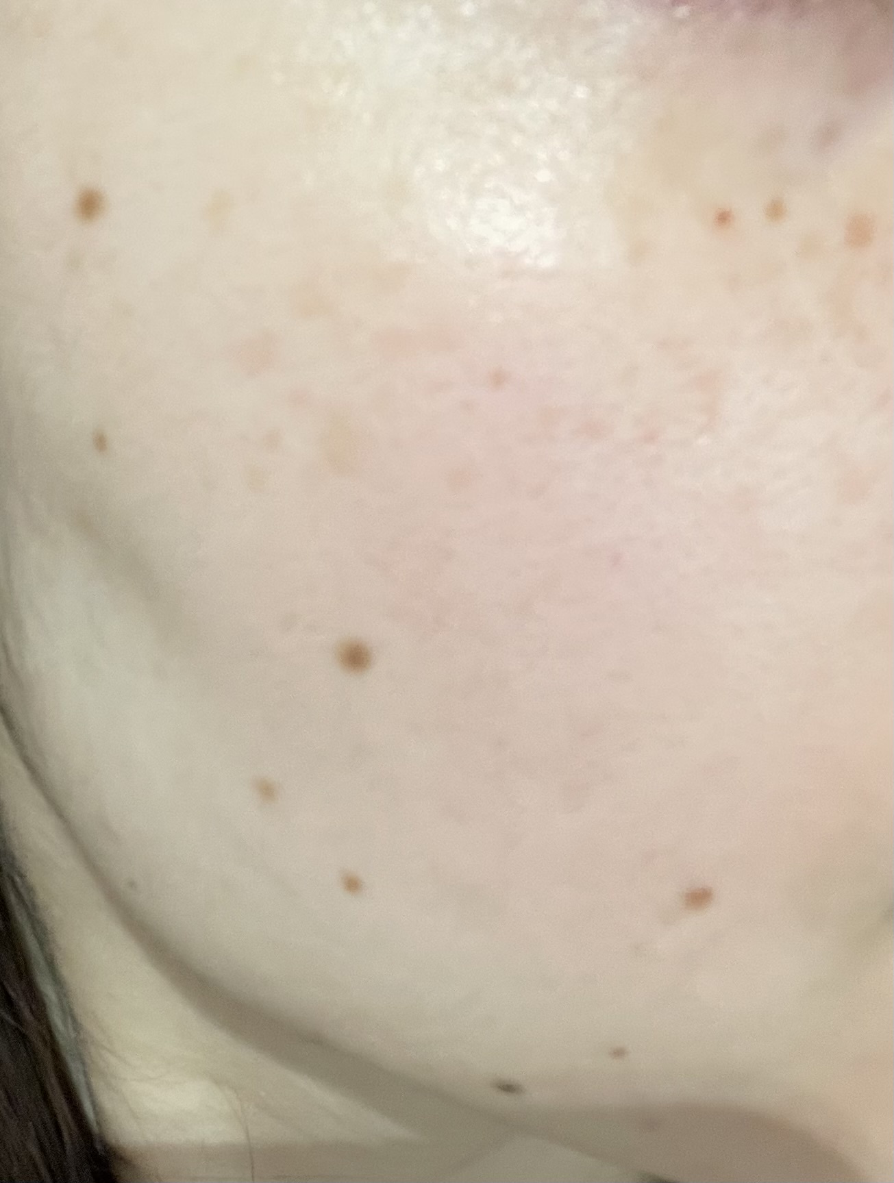 �X�L���P�Aby ���I1221����̉摜