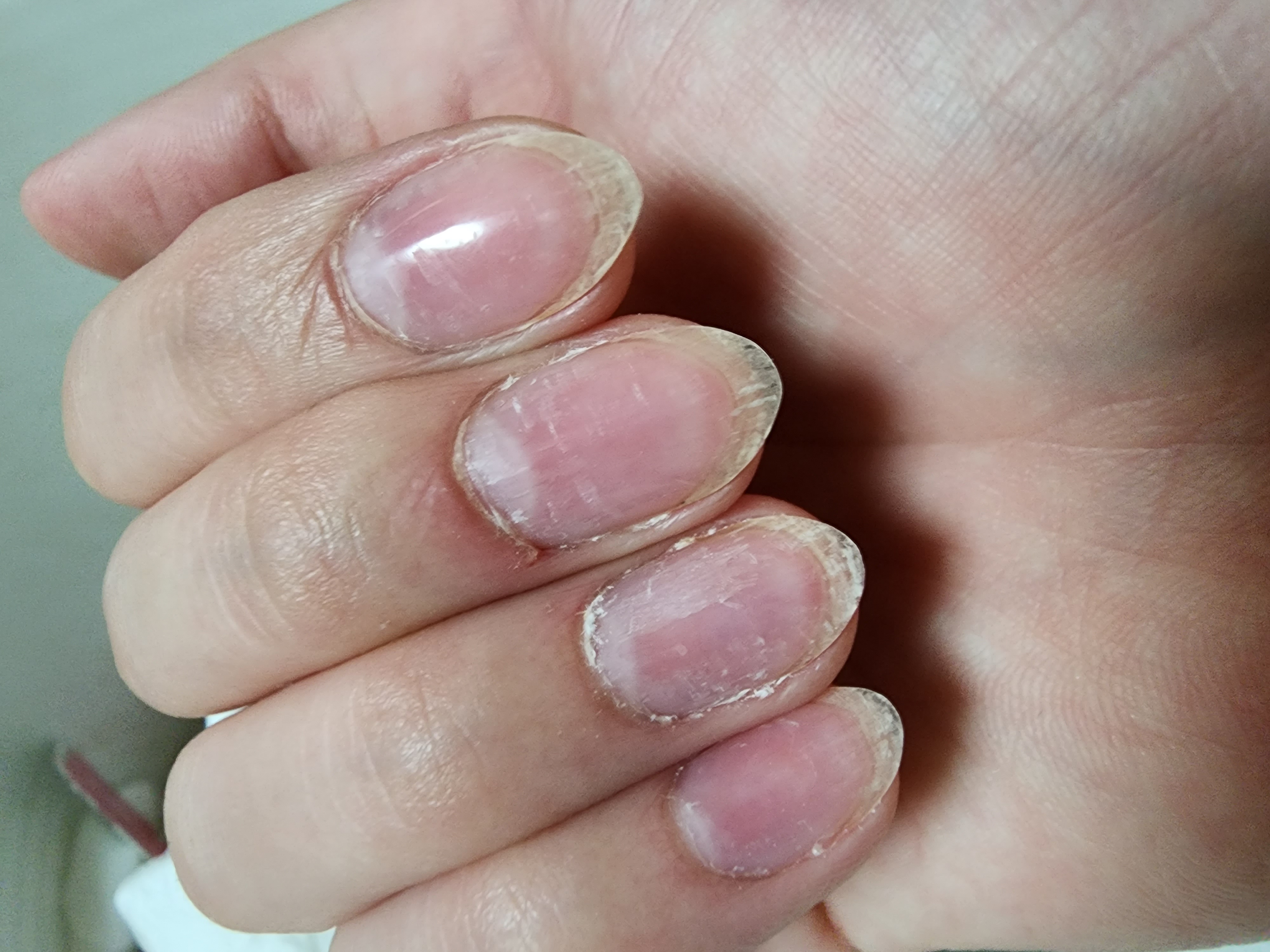 初ジェルネイル&OFF。。全く上手くいかんby やぴん077さんの画像