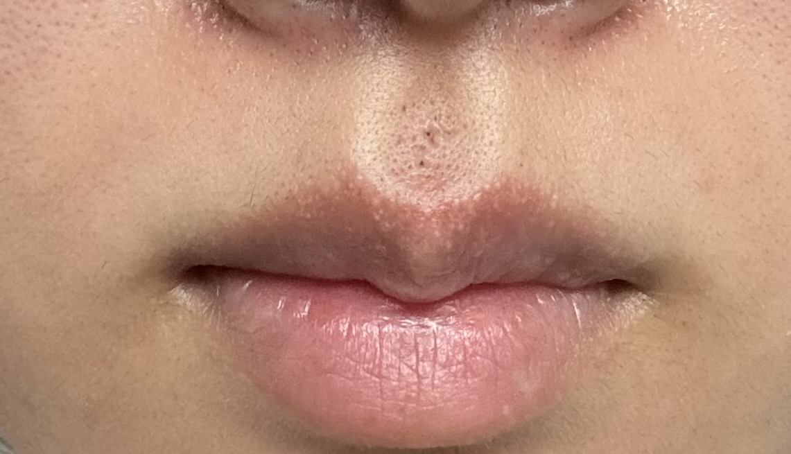 �@���̂����݂��B���R���V�[���[ by �ɂ��܂�̔炳�� �̉摜