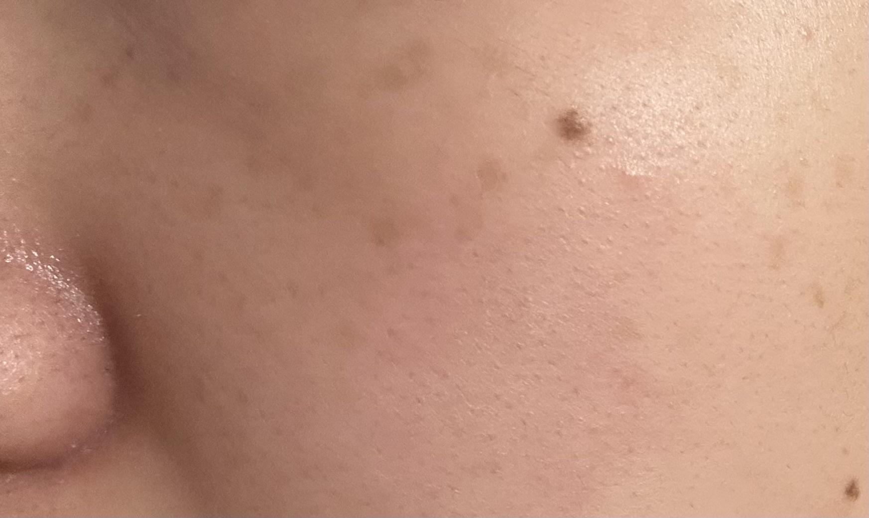 �V�~�i���΂����H�̔��H�j���B�������Iby �t�B�K��3������̉摜