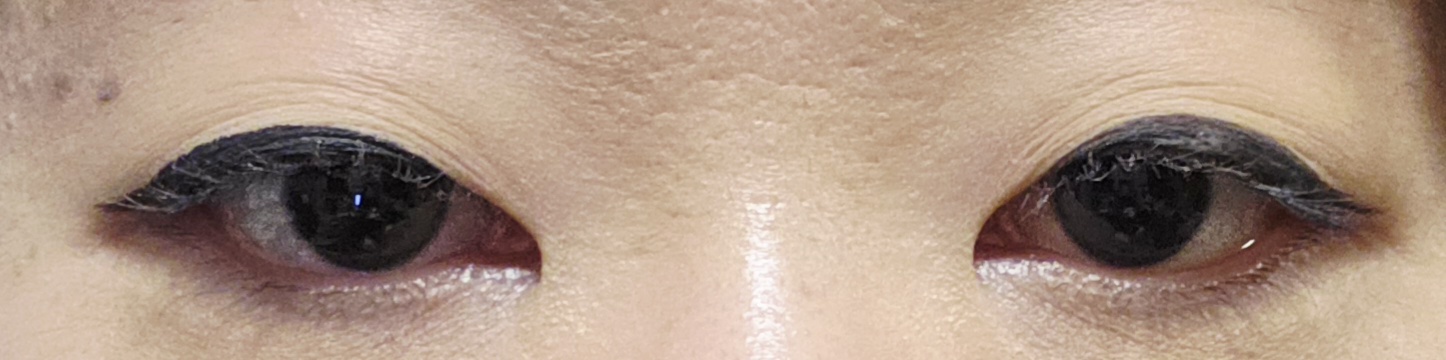 �A�C���C���ɂ���by hn106����̉摜