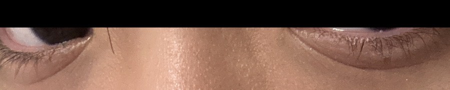 目頭のシワby 紫羽3015さんの画像