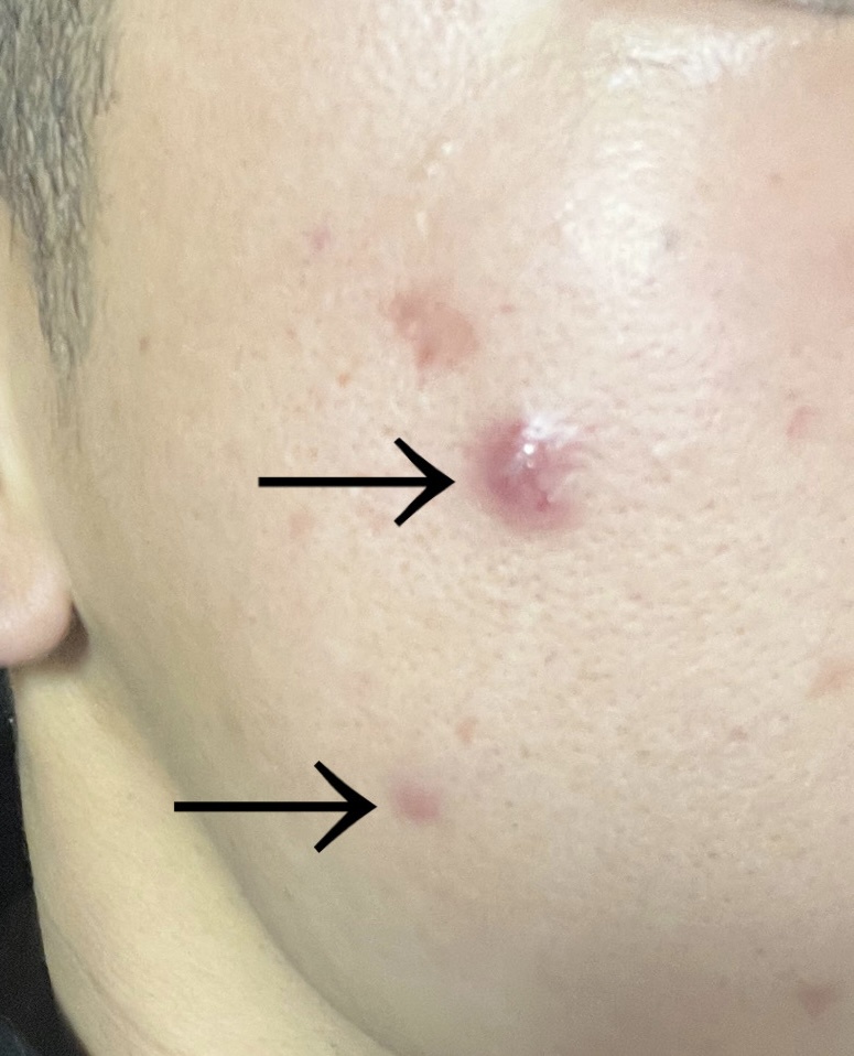 �j�L�r����� by �Ђ낫3969���� �̉摜