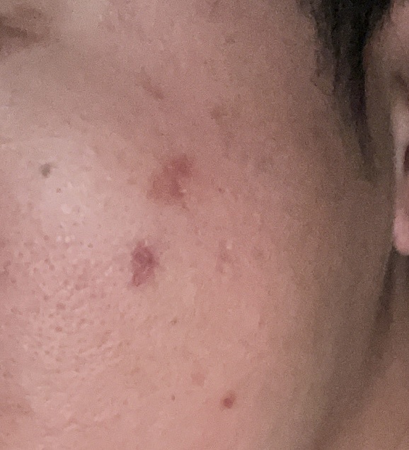 �V�~�@�j�L�r�Ձ@�F�f����by �Ђ낫3969����̉摜