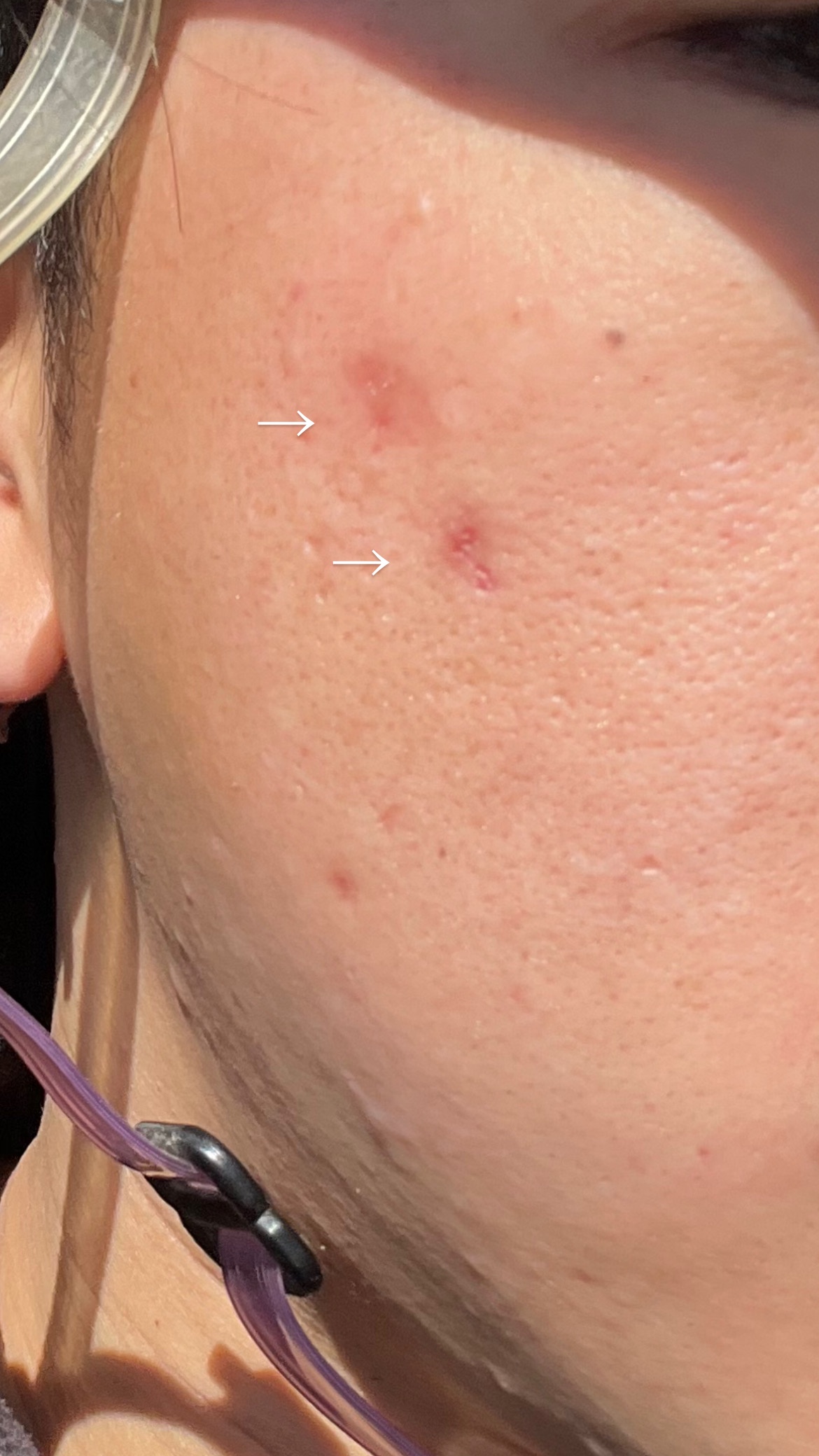 �j�L�r��by �Ђ낫3969����̉摜