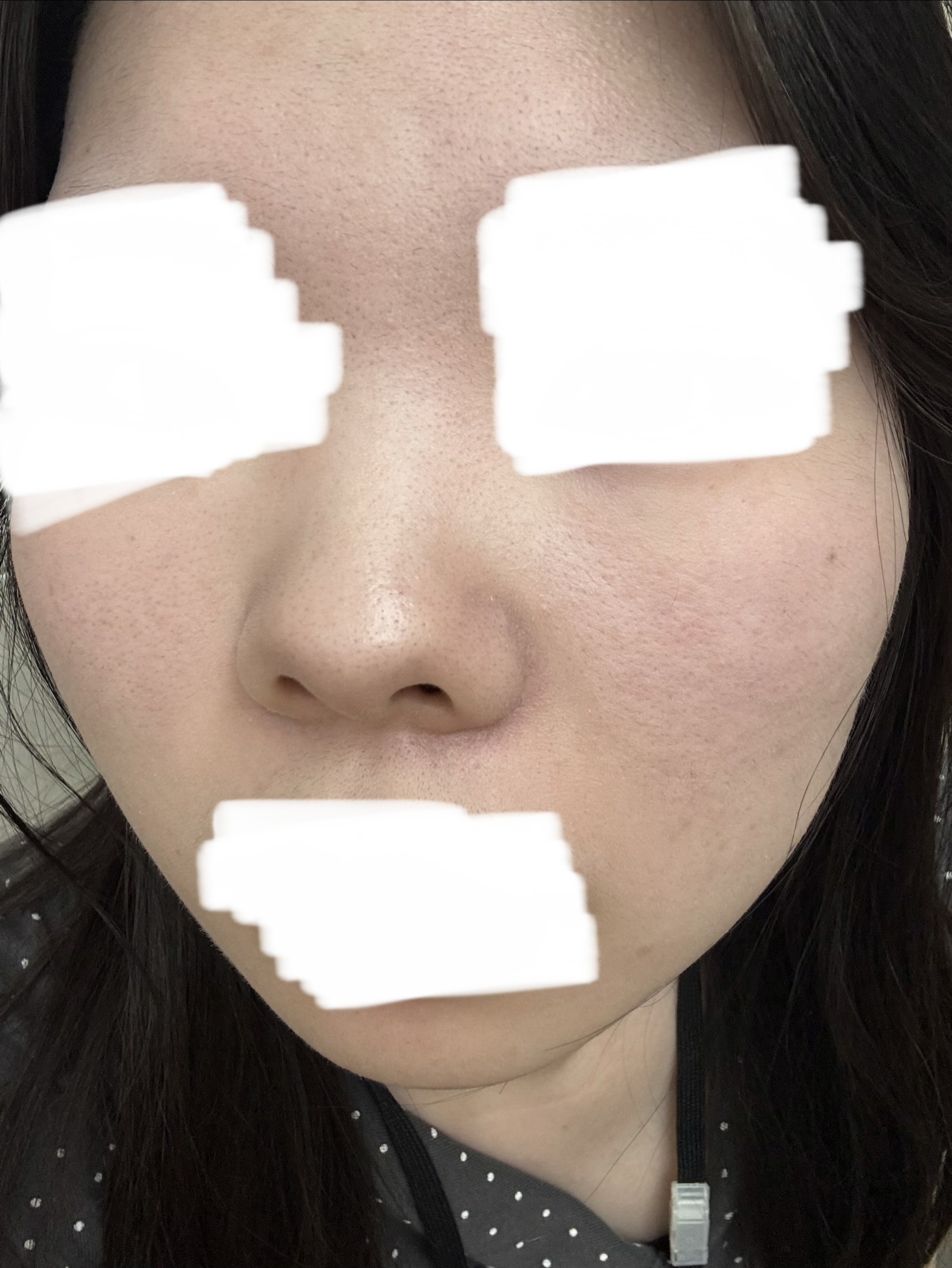 おすすめの美容医療を教えて欲しいです by はや2296さん の画像