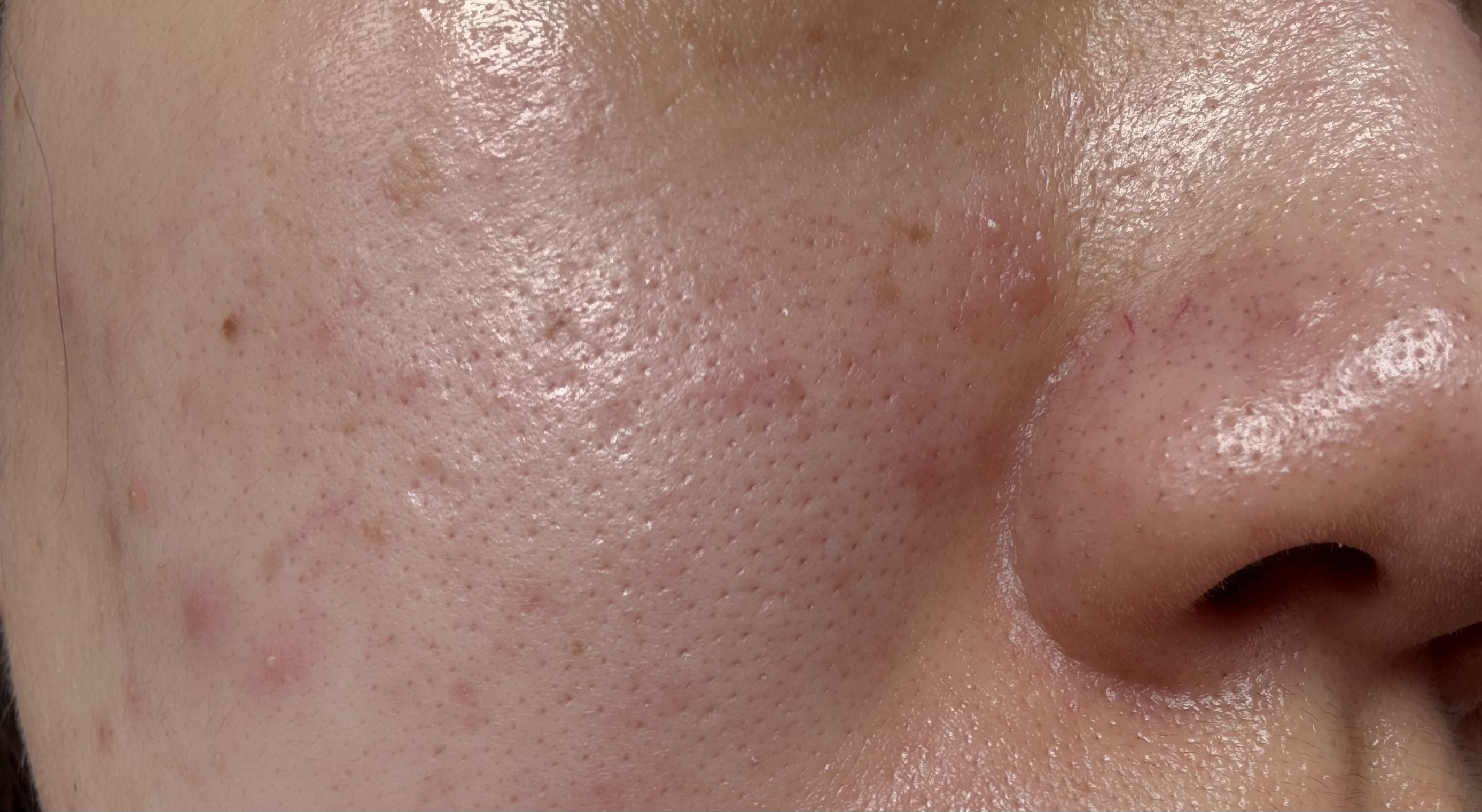 美容医療のオススメ教えてください!by ともちゃん...さんの画像