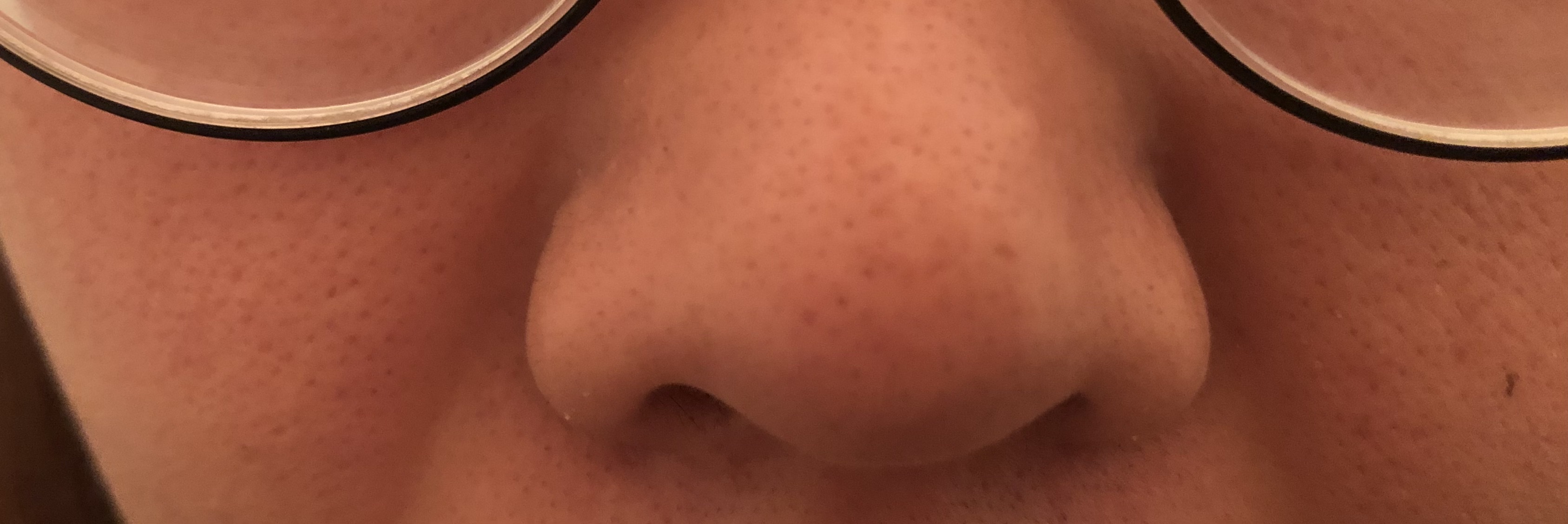 �X�L���P�Aby �Ղ��ՂՂՁ[�[����̉摜