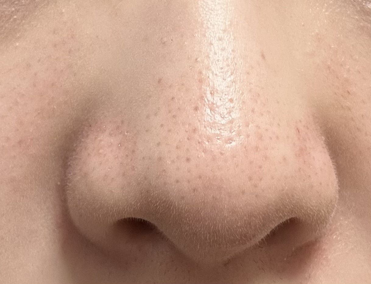 �y�ь��ʐ^���Ӂz�������ߔ��e�t�����Ă��������Iby _n.sa����̉摜