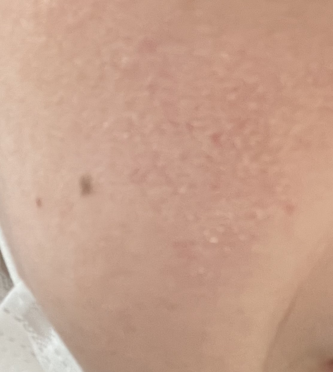 頬by 匿名さんの画像