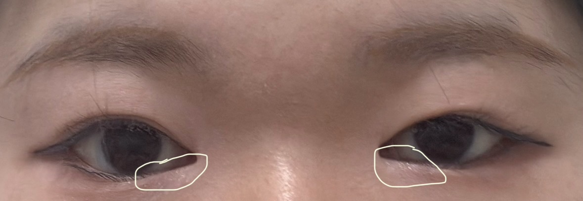 �A�C���C�N����肭�����܂���I(�G�G)by ��������̉摜