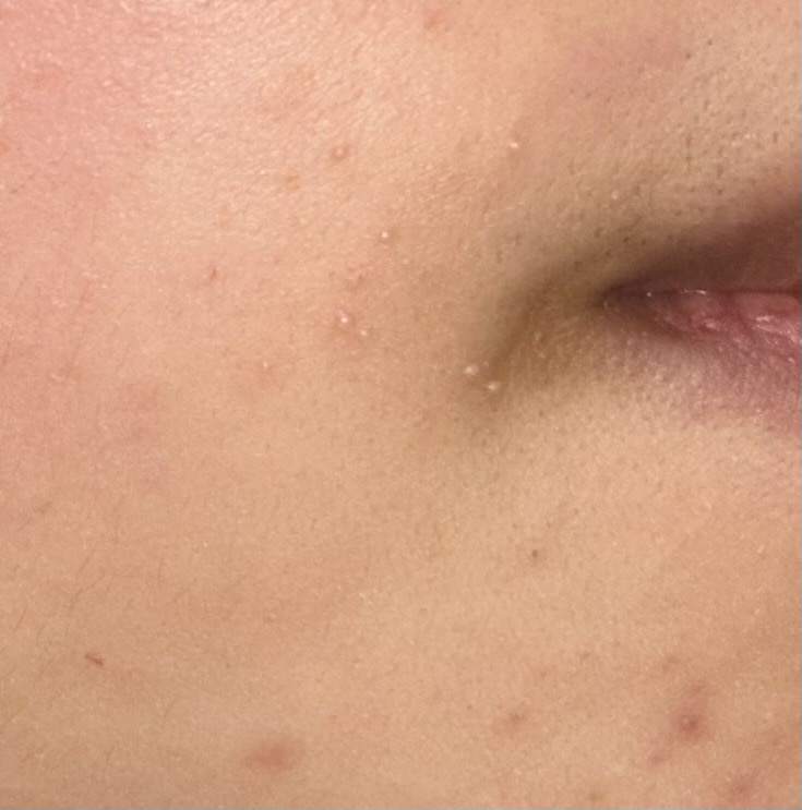 �q���������������̔��e�t�������Ă�������by ���Ȃ��a�炳��̉摜