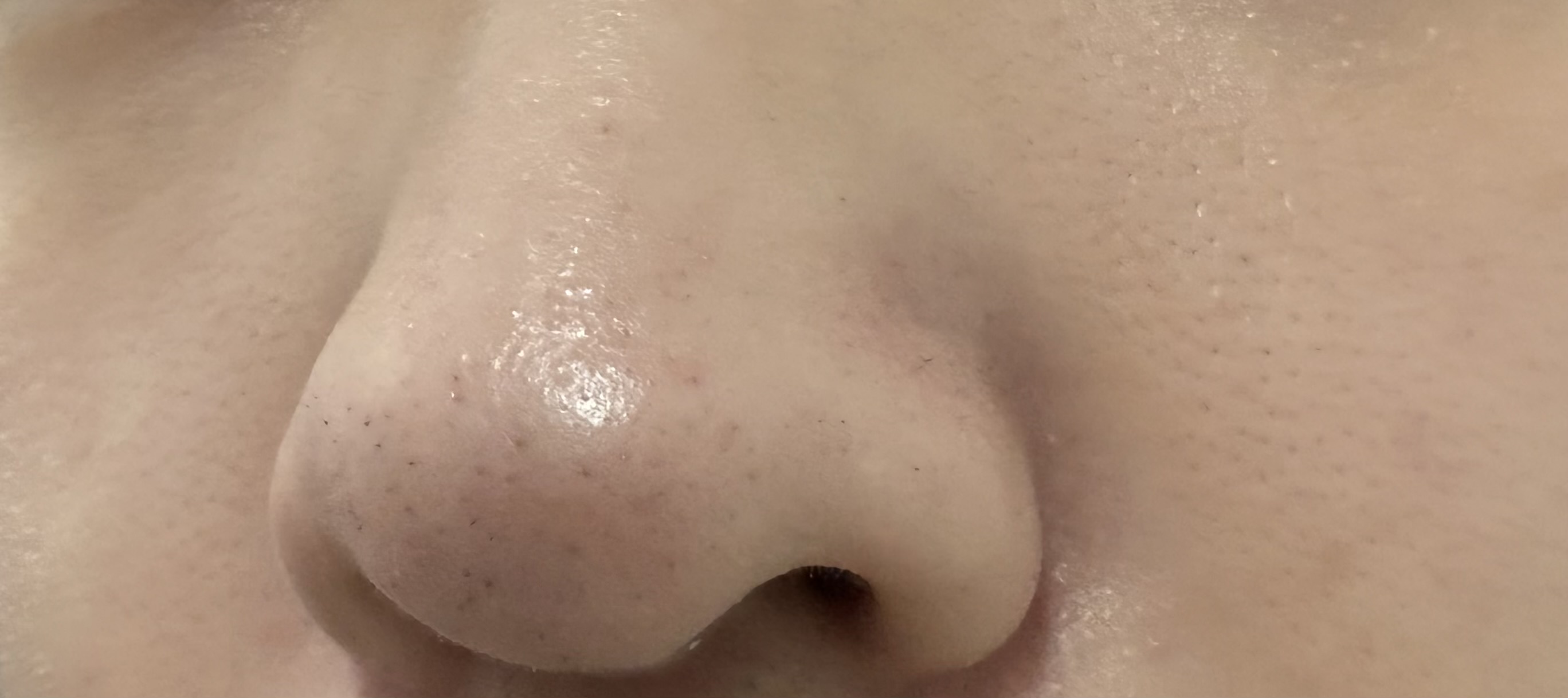 �ь��P�A�ɂ���by ���Ϗ��S��7913����̉摜