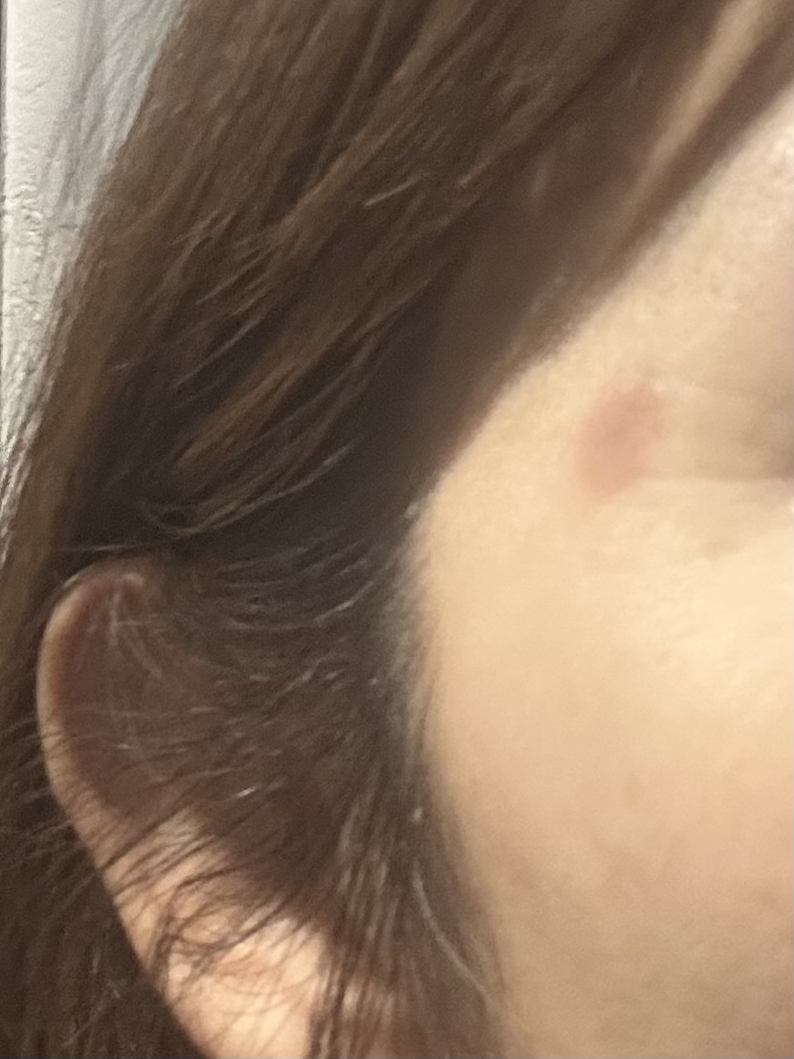 �n�C�h���L�m���ɂ��� by �������� �̉摜