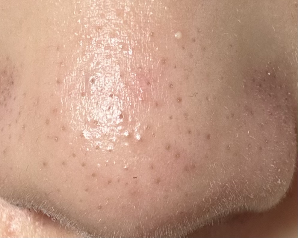 �ь��ɂ���by ���I���I��I����̉摜