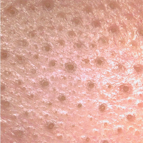 眉間のつまり毛穴by ちゃか0654さんの画像