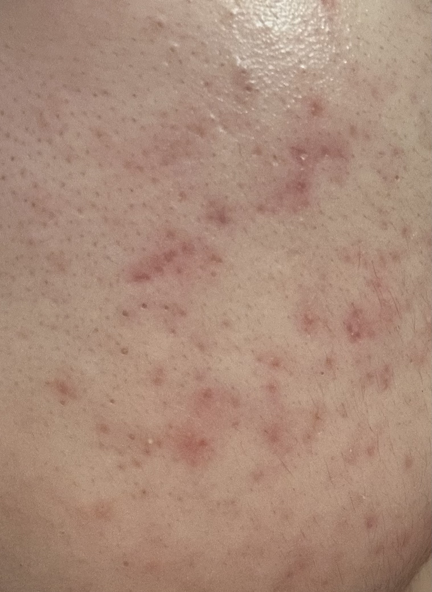 �j�L�r��by ���Ⴉ0654����̉摜