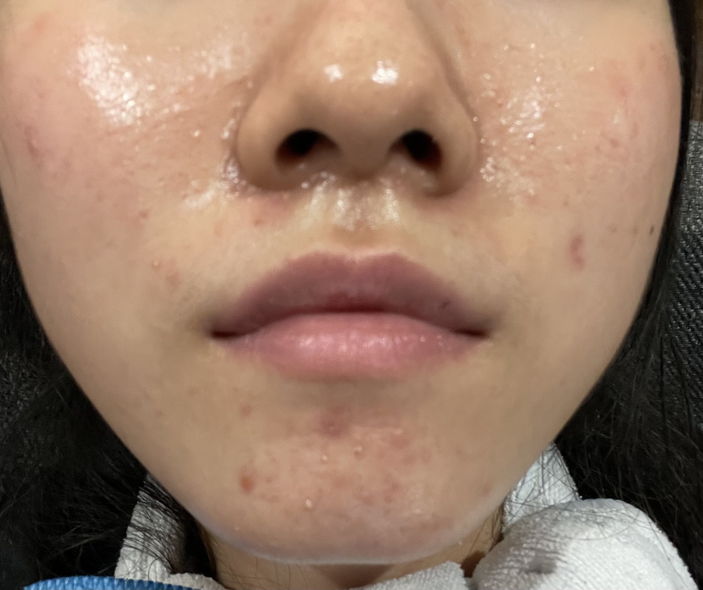 ���r��by �΂�2343����̉摜