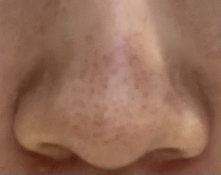 鼻が黒いby ばっ2343さんの画像