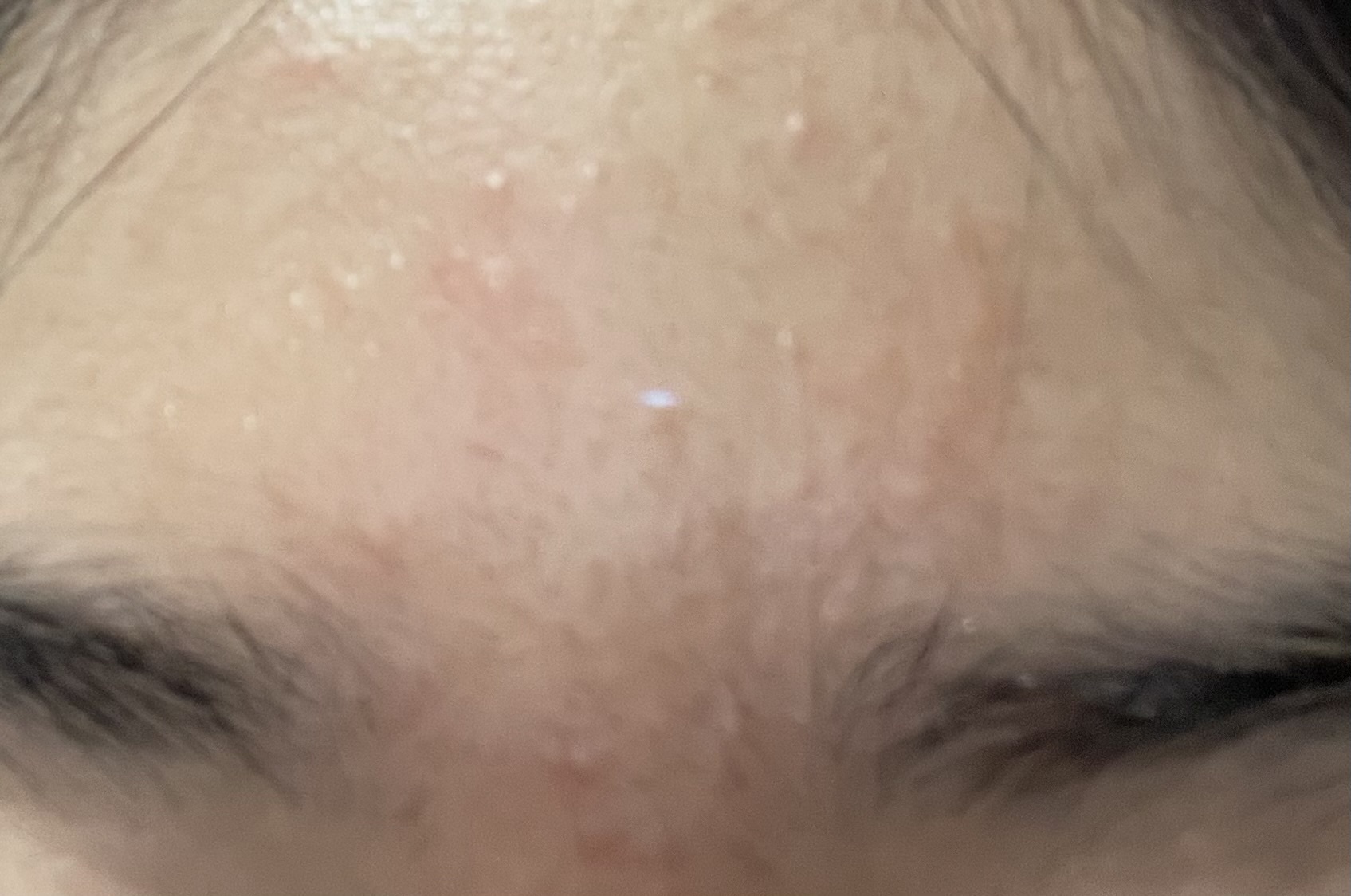 おでこby ばっ2343さんの画像