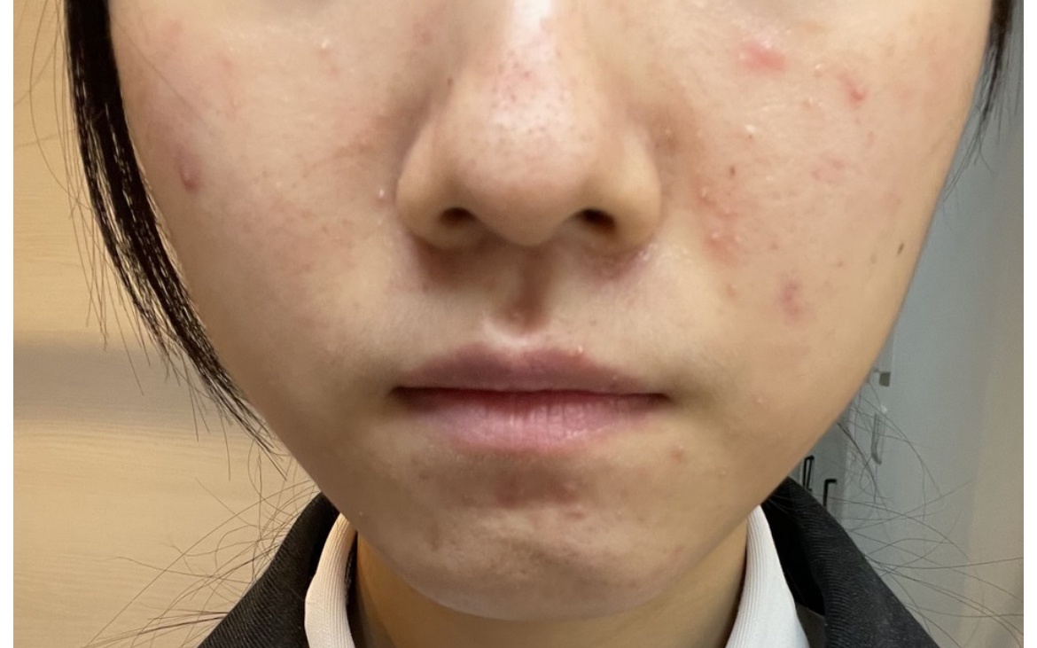 化粧水by ばっ2343さんの画像