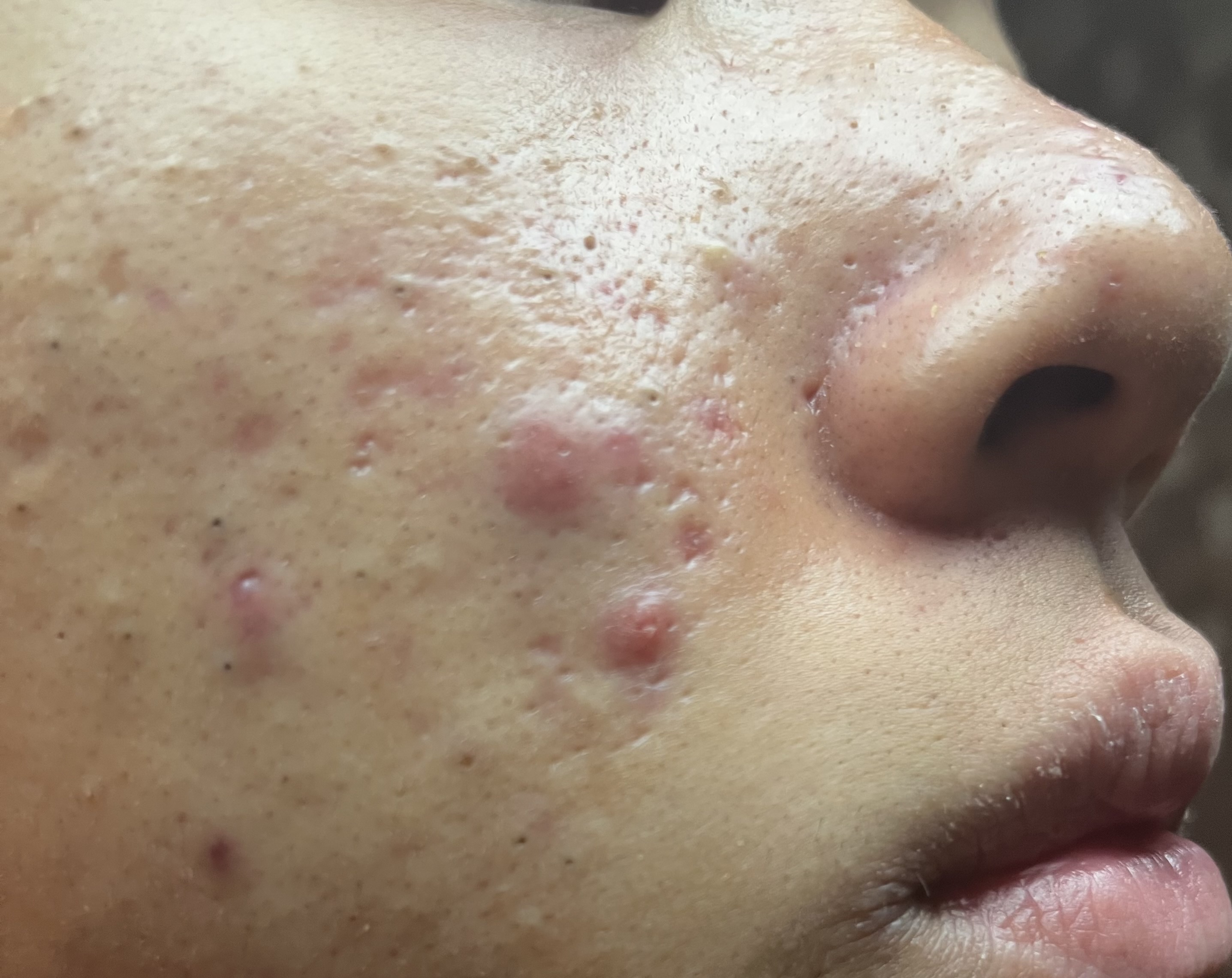 スキンケアや食生活直した方がいいところ教えてくださいby こみそうさんの画像