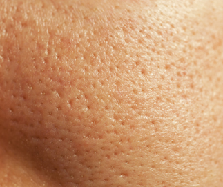 �ق��؂̖ь��Y��by ��������̉摜