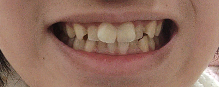 ������ by ��肩7400���� �̉摜