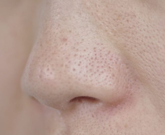 �������@by ��������̉摜