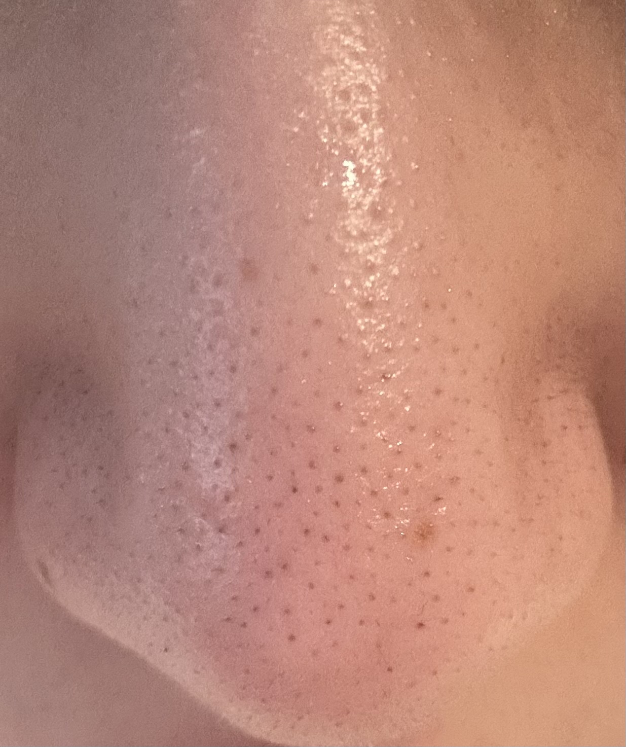 �������@by ��7756����̉摜