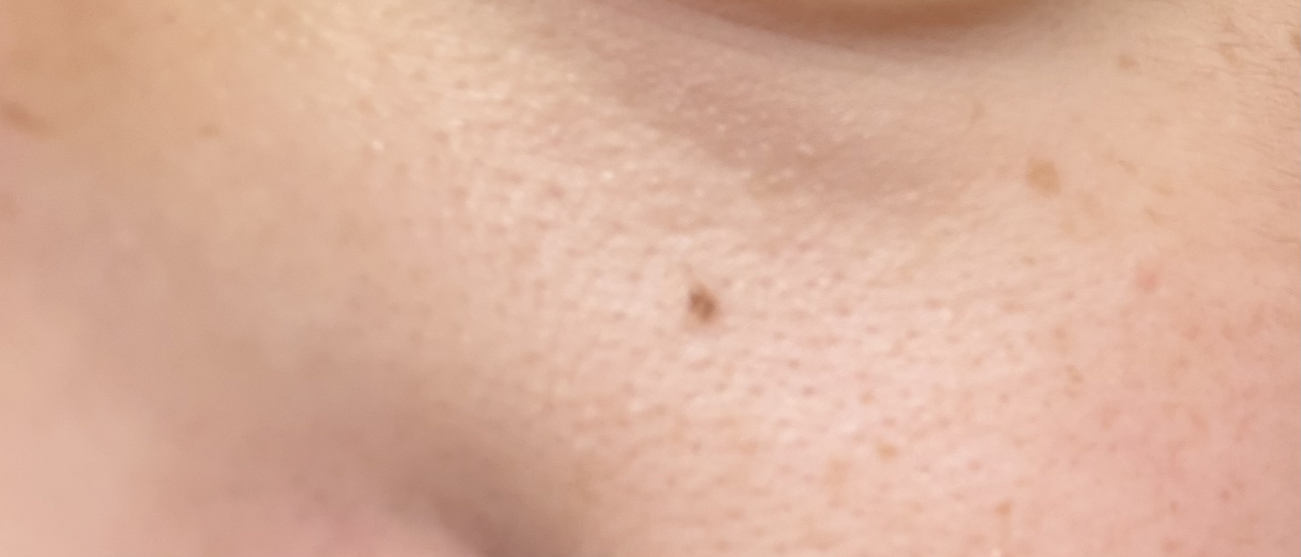 �X�L���P�A by �ڈɍ؂��� �̉摜