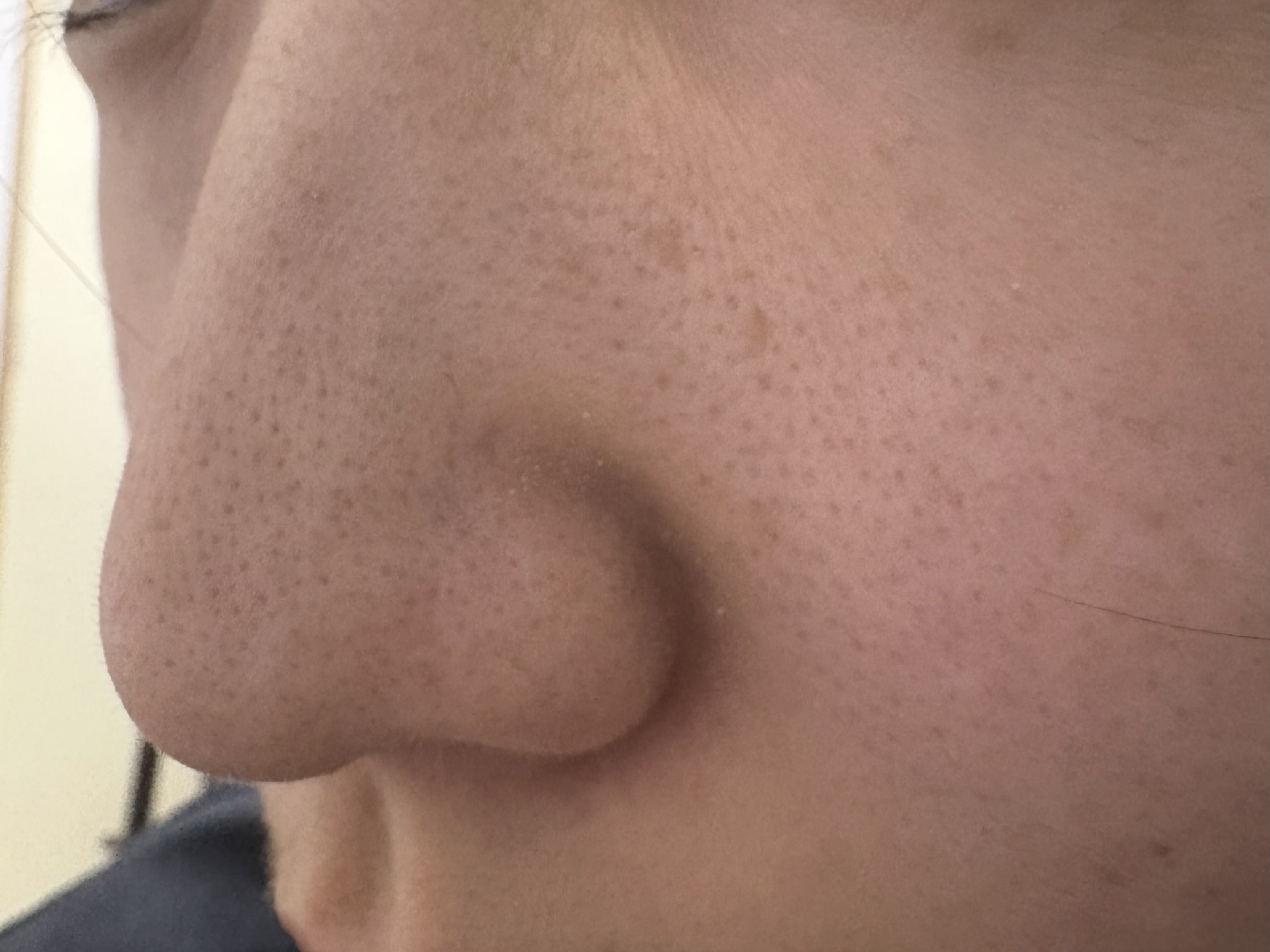 �������߂̐��by l7sfy����̉摜