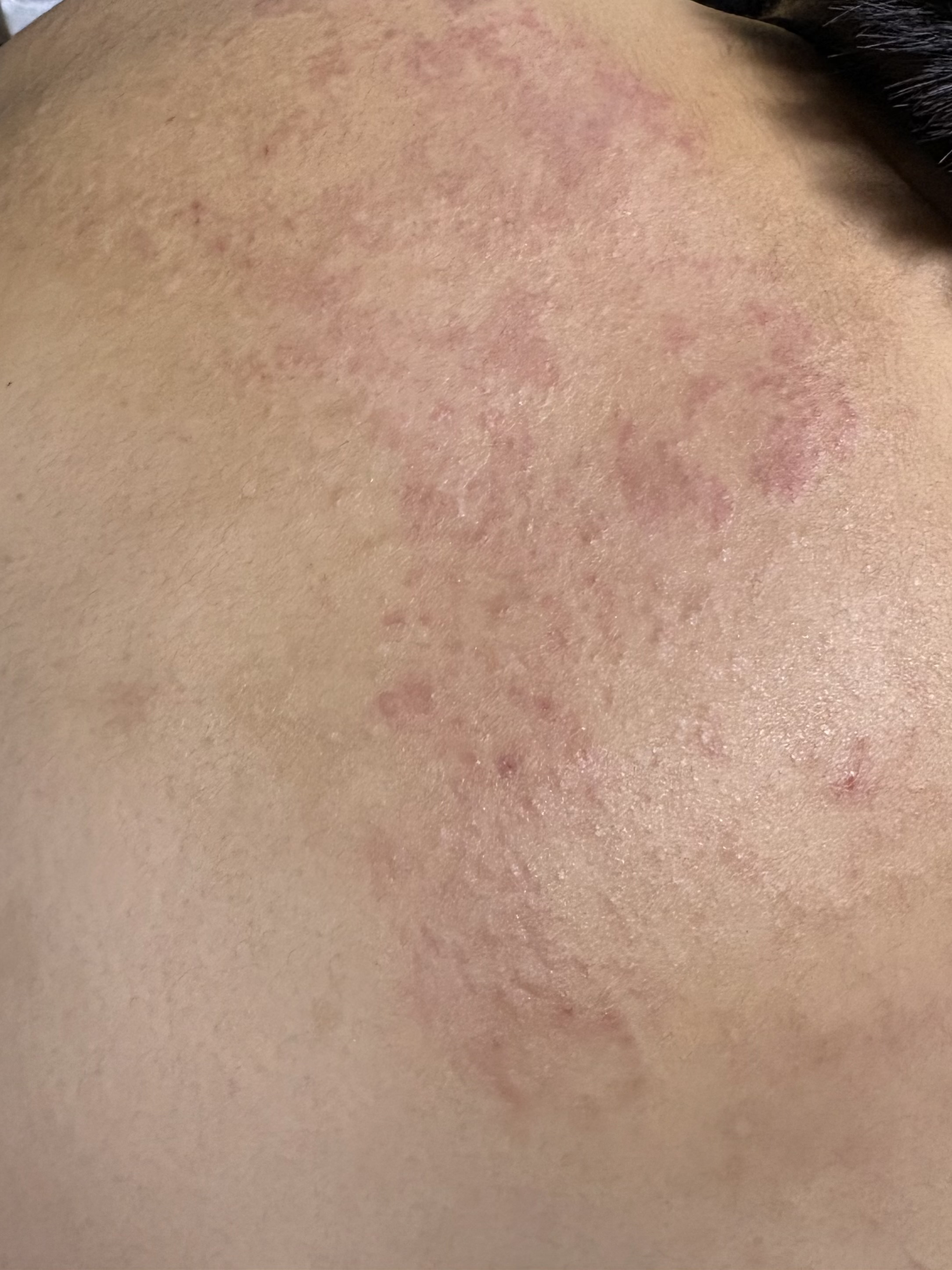 �w���r��by l7sfy����̉摜