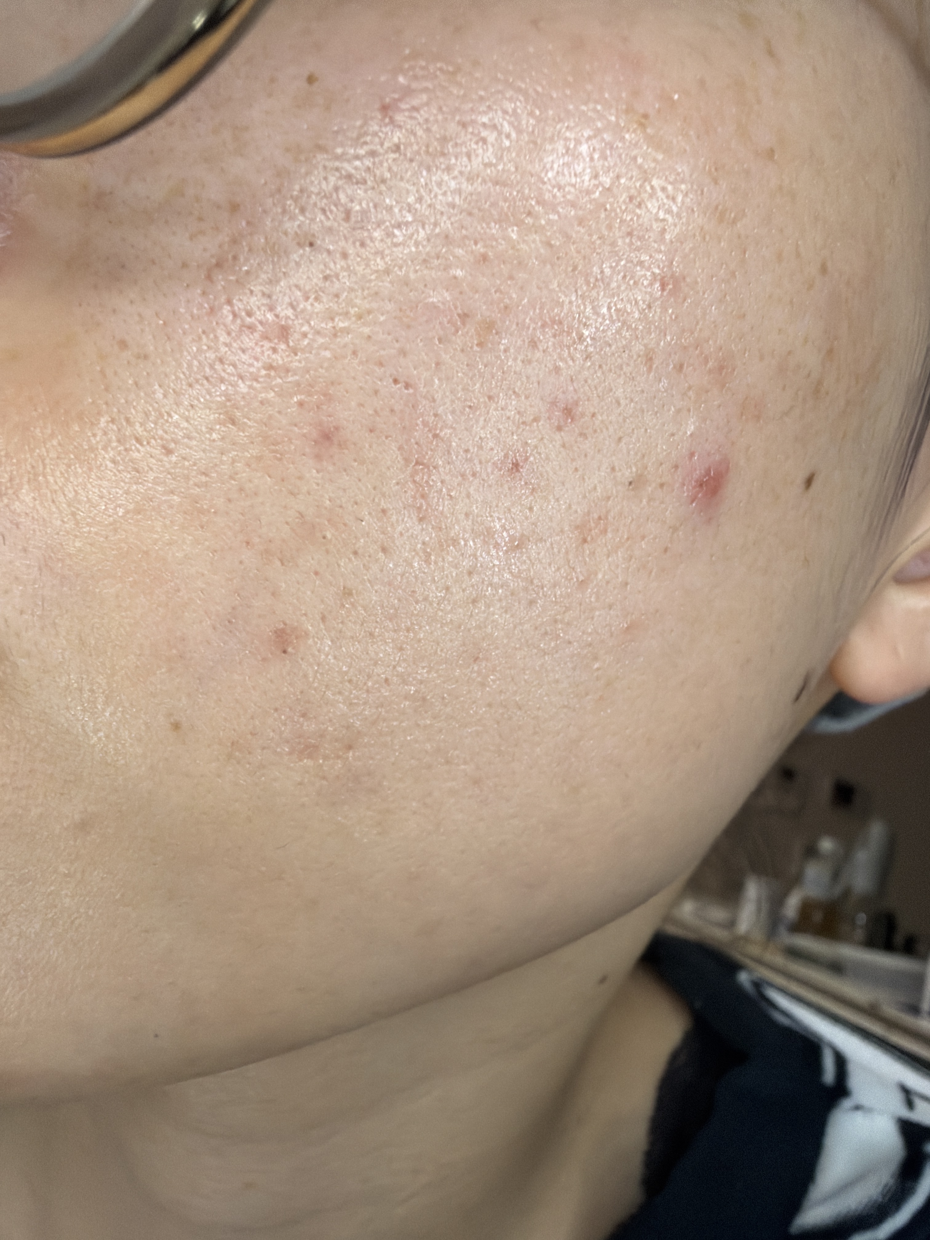 ���������Ă��݂܂���Bby �Ղ��1972����̉摜