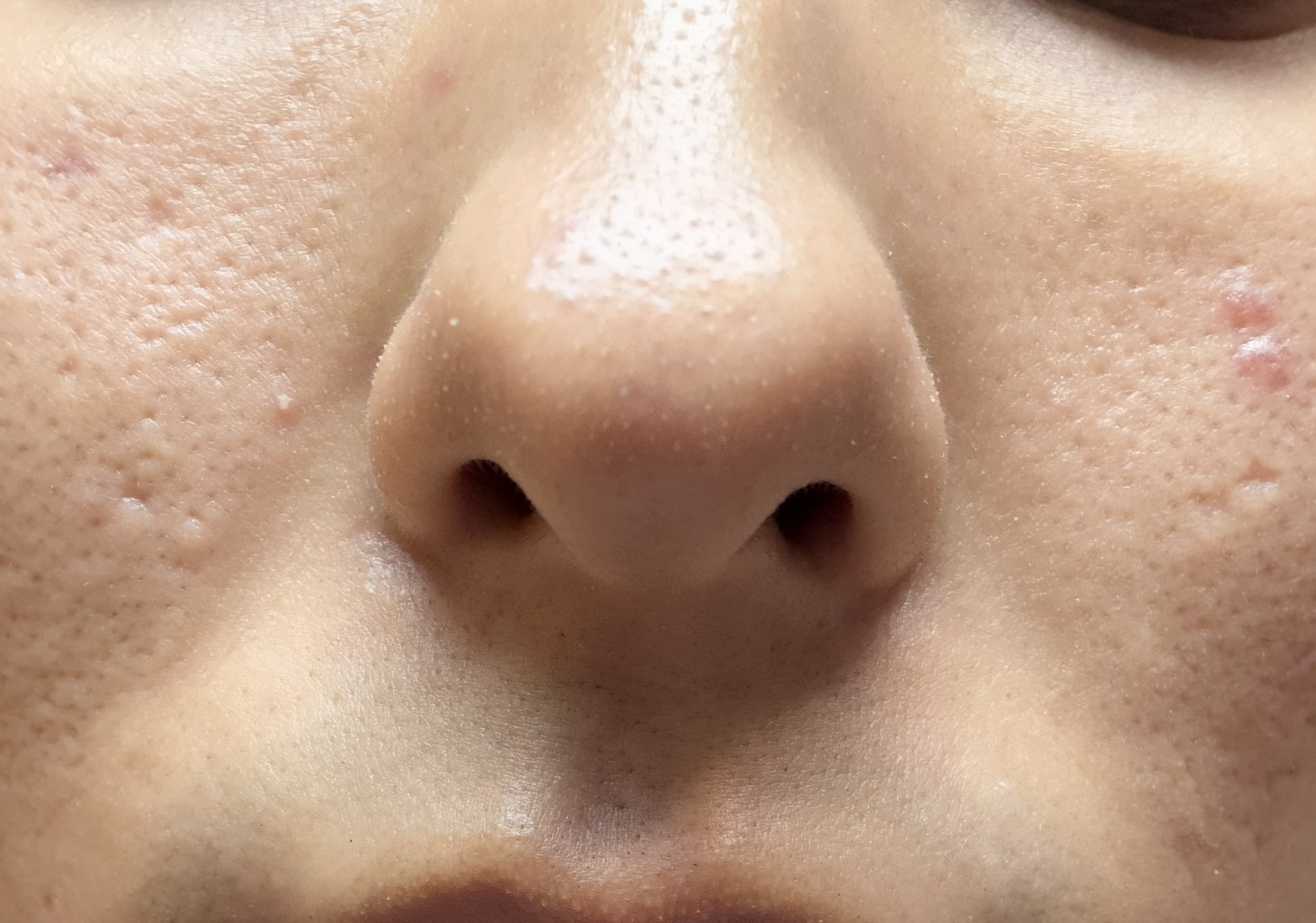 �y��摜����z�����Y��ɂ�����@�������Ăق����ł�by ����͗l����̉摜