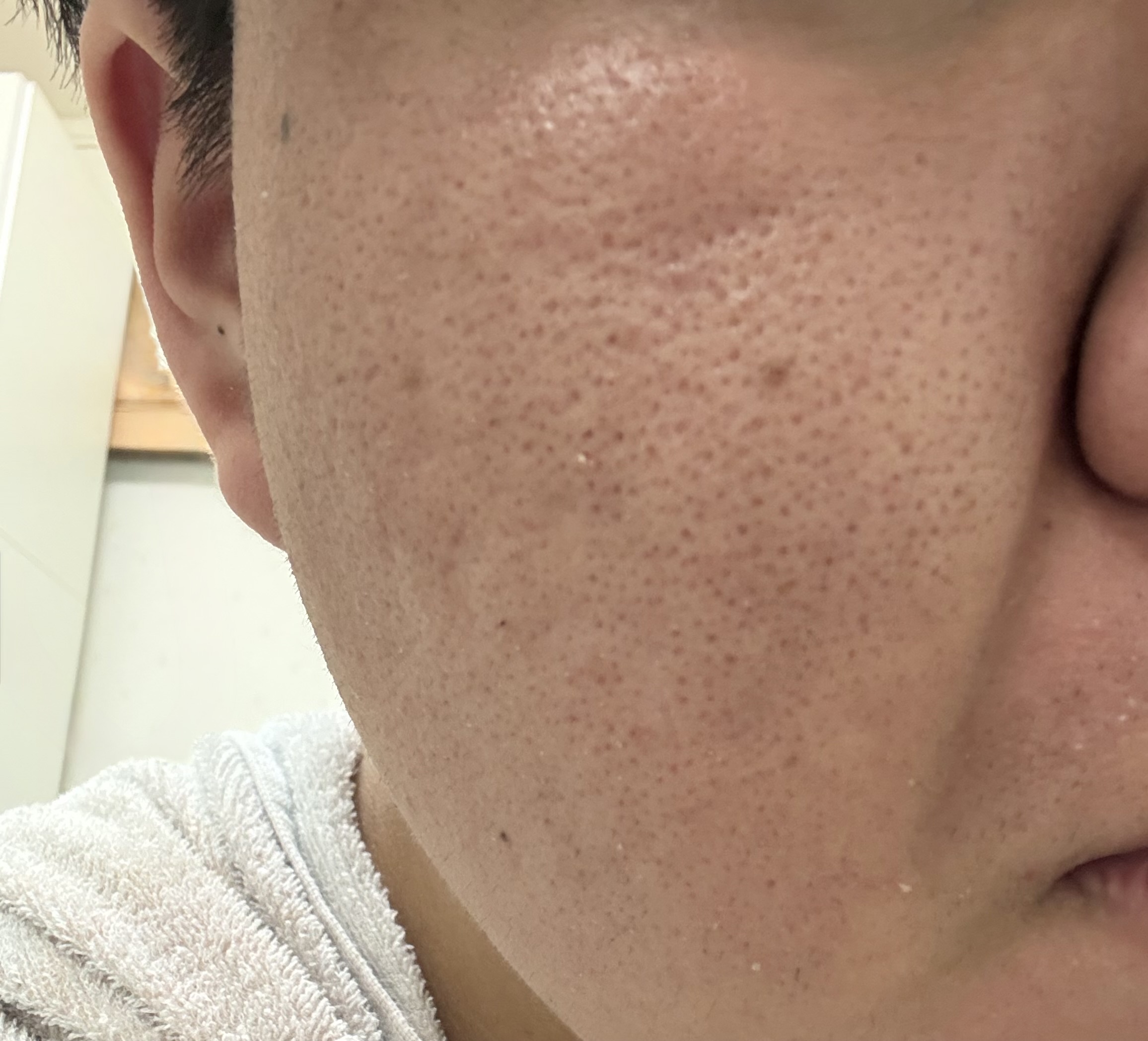 �X�L���P�A�ɂ��ĕ��������ł��Iby UL9985����̉摜