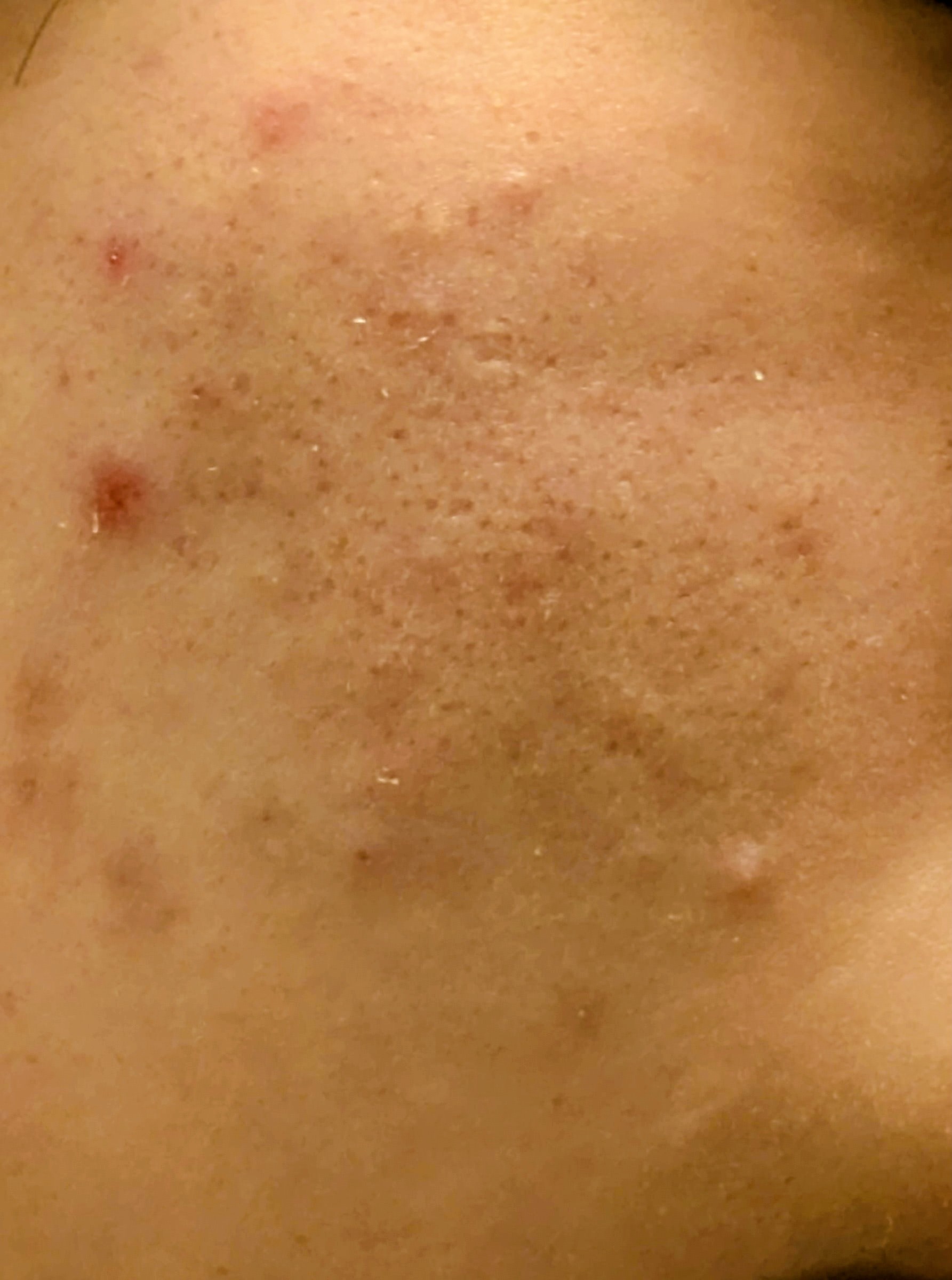 �j�̖ь��̉��P���@�������Ă�������by �ɂ�22222����̉摜
