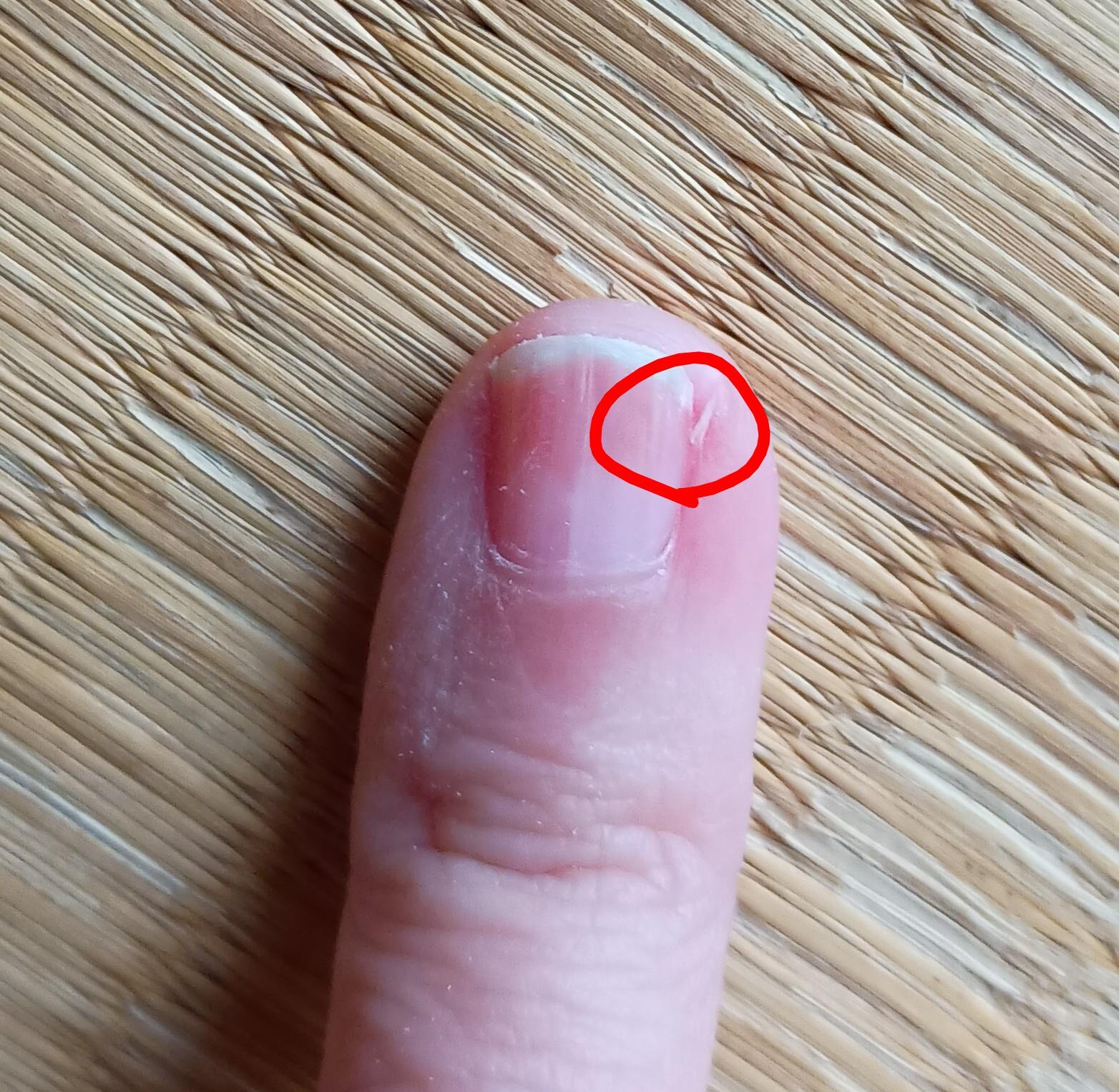 �܂����ƁA���̂悤�ɂȂ��Ă��܂��܂�by ��������̉摜