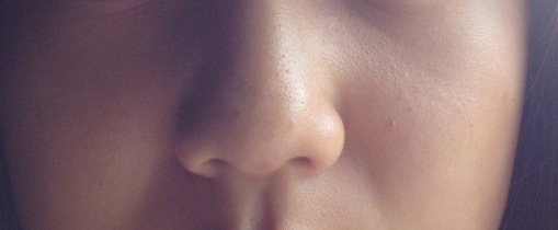 女子高生 頬 鼻の毛穴について こんにちわ 今 Q A Cosme アットコスメ