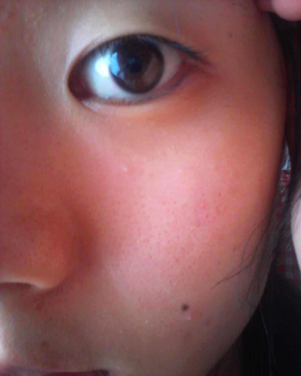 蒙古ひだが強すぎて タイトルの通り画像は下に載せてい Q A Cosme アットコスメ