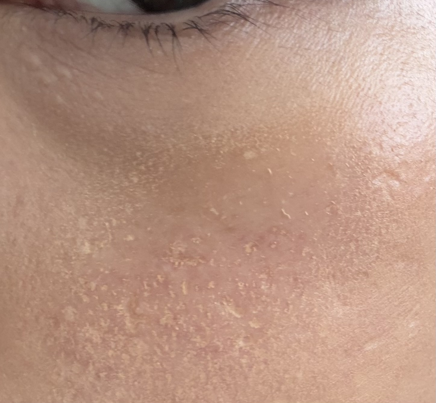 �x�[�X���C�N�ɂ���by mr2tr5����̉摜