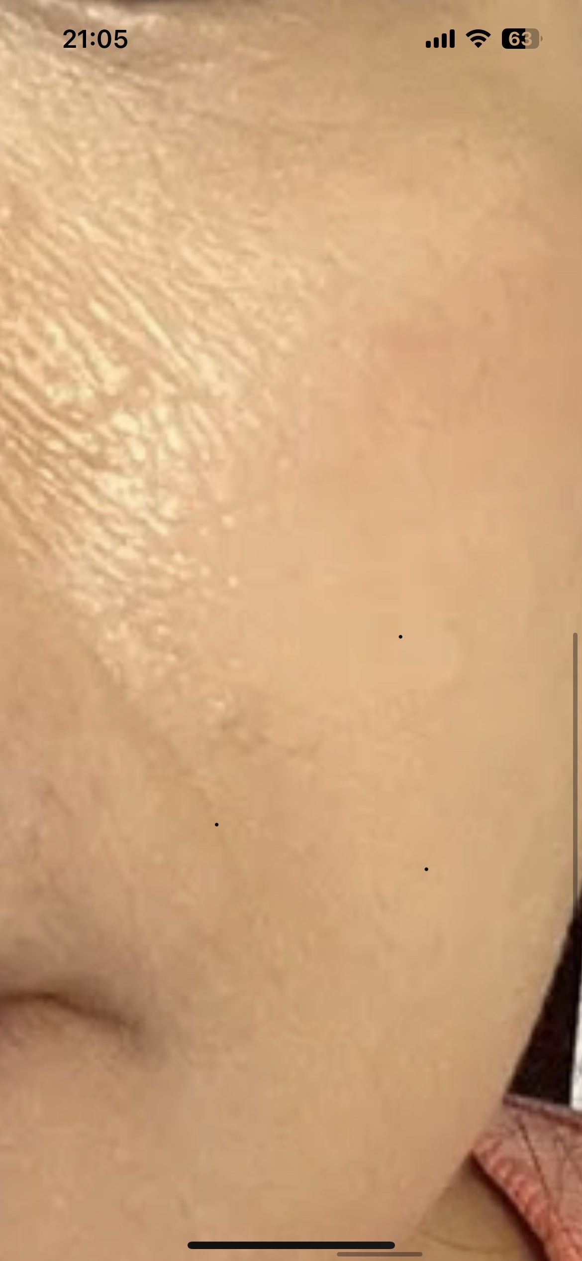 鼻の横のシワが酷いです。by あやべるりさんの画像