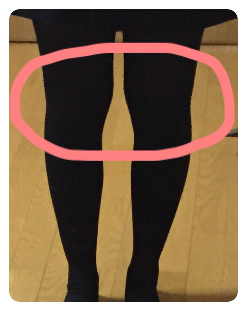 膝上 膝横 の肉 太ももの太さの解消法は 脚の形がとて Q A Cosme アットコスメ