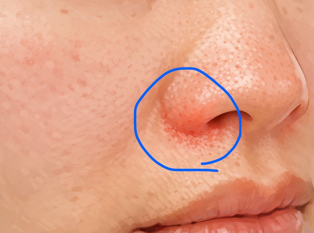 ���܂�΍�by �T�s����̉摜