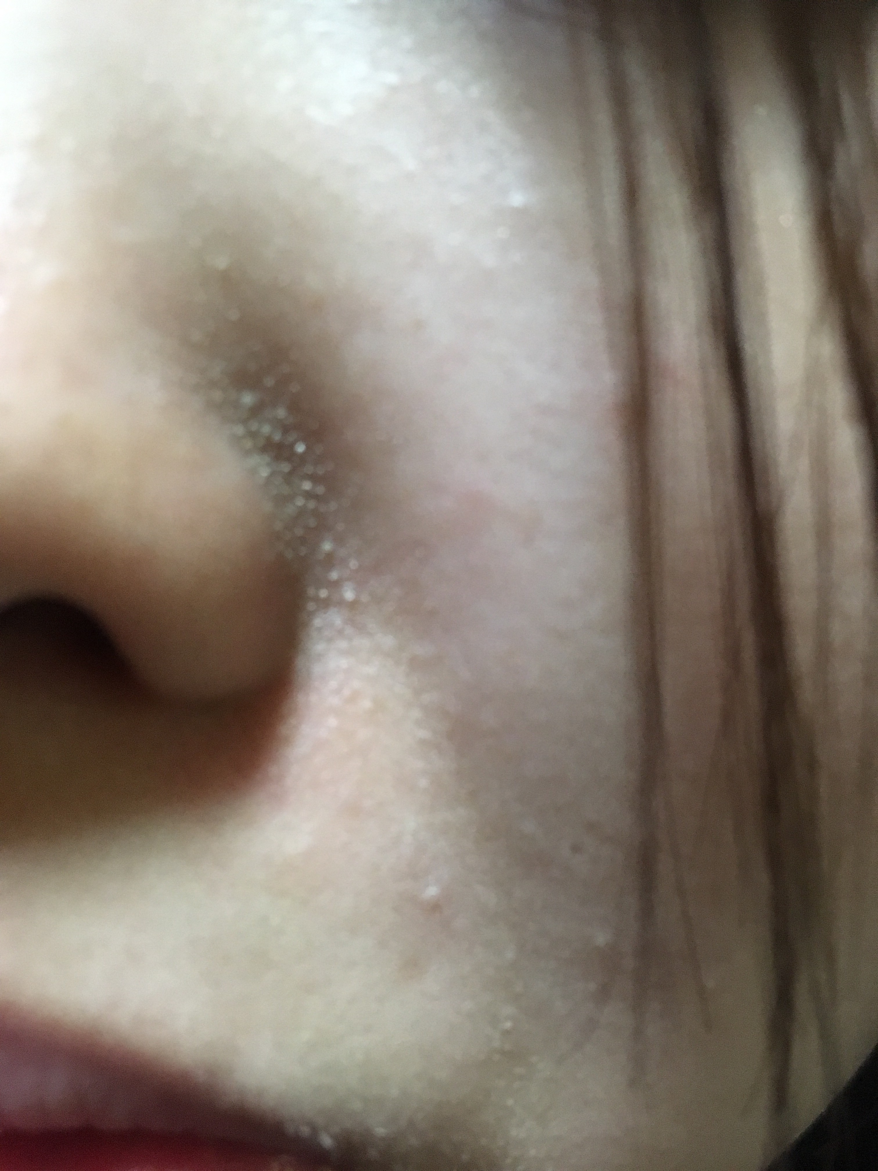 鼻の白いポツポツ 私は昔から小鼻がいちごで特に左脇の方が Q A Cosme アットコスメ